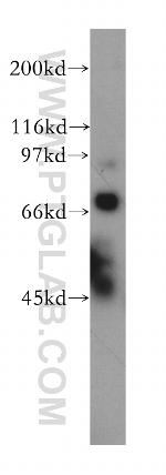 TDRD3 Antibody in Western Blot (WB)