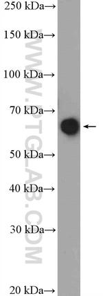 Glycerokinase Antibody in Western Blot (WB)