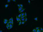 Glycerokinase Antibody in Immunocytochemistry (ICC/IF)