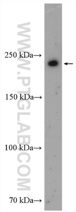 PIP5K3 Antibody in Western Blot (WB)
