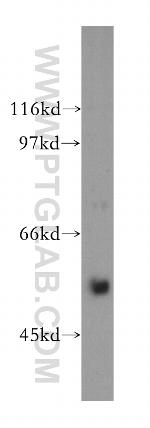 LMAN1 Antibody in Western Blot (WB)
