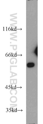 LMAN1 Antibody in Western Blot (WB)