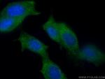 PPP1R12B Antibody in Immunocytochemistry (ICC/IF)