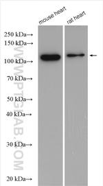 PPP1R12B Antibody in Western Blot (WB)