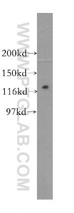 PPP1R12B Antibody in Western Blot (WB)
