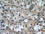 TFEB Antibody in Immunohistochemistry (Paraffin) (IHC (P))