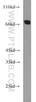 TFEB Antibody in Western Blot (WB)