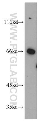 TFEB Antibody in Western Blot (WB)