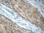 LYNX1 Antibody in Immunohistochemistry (Paraffin) (IHC (P))