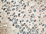 Amphiphysin Antibody in Immunohistochemistry (Paraffin) (IHC (P))