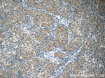 HSPH1 Antibody in Immunohistochemistry (Paraffin) (IHC (P))