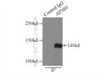 AP3B1 Antibody in Immunoprecipitation (IP)