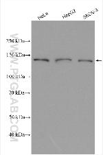 AP3B1 Antibody in Western Blot (WB)
