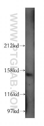 AP3B1 Antibody in Western Blot (WB)