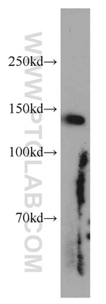 AP3B1 Antibody in Western Blot (WB)