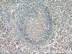 PFKP Antibody in Immunohistochemistry (Paraffin) (IHC (P))