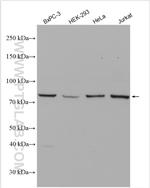 PFKP Antibody in Western Blot (WB)