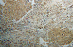 CLEC1A Antibody in Immunohistochemistry (Paraffin) (IHC (P))