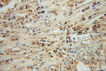 CLEC1A Antibody in Immunohistochemistry (Paraffin) (IHC (P))