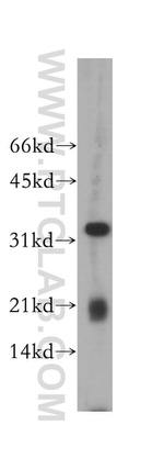 CLEC1A Antibody in Western Blot (WB)