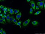 MIP-3-beta Antibody in Immunocytochemistry (ICC/IF)