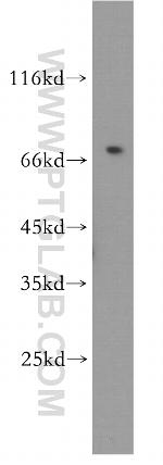 GPR161 Antibody in Western Blot (WB)