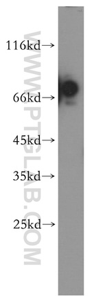 GPR161 Antibody in Western Blot (WB)