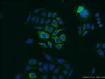 Zinc-alpha-2-glycoprotein Antibody in Immunocytochemistry (ICC/IF)