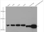 PHKB Antibody in Western Blot (WB)