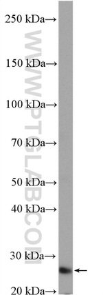 PAQR4 Antibody in Western Blot (WB)
