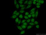 CHD9 Antibody in Immunocytochemistry (ICC/IF)