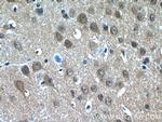 PDP2 Antibody in Immunohistochemistry (Paraffin) (IHC (P))
