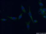 TRIM38 Antibody in Immunocytochemistry (ICC/IF)