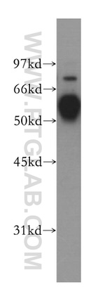 TRIM38 Antibody in Western Blot (WB)
