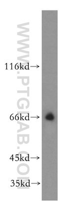 SLC19A3 Antibody in Western Blot (WB)