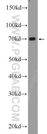 SLC19A3 Antibody in Western Blot (WB)