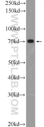 SLC19A3 Antibody in Western Blot (WB)