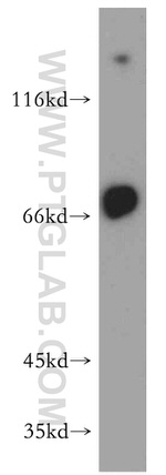 TRPV6 Antibody in Western Blot (WB)