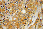 RAB27B Antibody in Immunohistochemistry (Paraffin) (IHC (P))