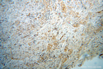 HRH1 Antibody in Immunohistochemistry (Paraffin) (IHC (P))