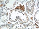 HSD17B3 Antibody in Immunohistochemistry (Paraffin) (IHC (P))