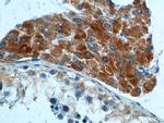 HSD17B3 Antibody in Immunohistochemistry (Paraffin) (IHC (P))