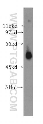 GPR17 Antibody in Western Blot (WB)