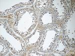 MED19 Antibody in Immunohistochemistry (Paraffin) (IHC (P))