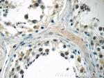 MED19 Antibody in Immunohistochemistry (Paraffin) (IHC (P))