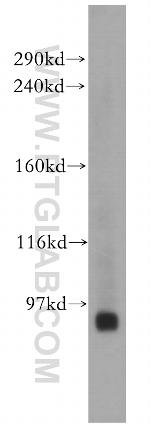 E2F8 Antibody in Western Blot (WB)