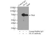 DLAT Antibody in Immunoprecipitation (IP)