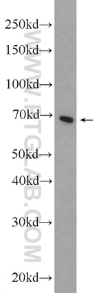 DLAT Antibody in Western Blot (WB)