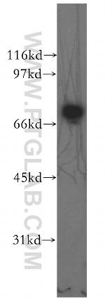 DLAT Antibody in Western Blot (WB)