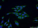 NDUFV3 Antibody in Immunocytochemistry (ICC/IF)
